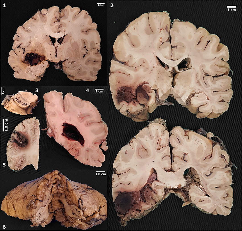 Gross pathology